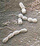 streptococ.jpg